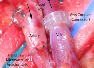 F2: Arterial and venous microvascular anastomosis 