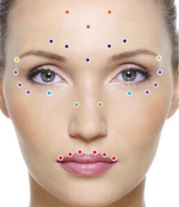 F5: Areas - points of Botox injections for facial rejuvenation