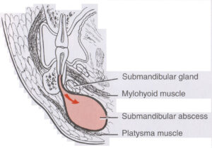 F7: Anatomical boundaries of the submandibular space